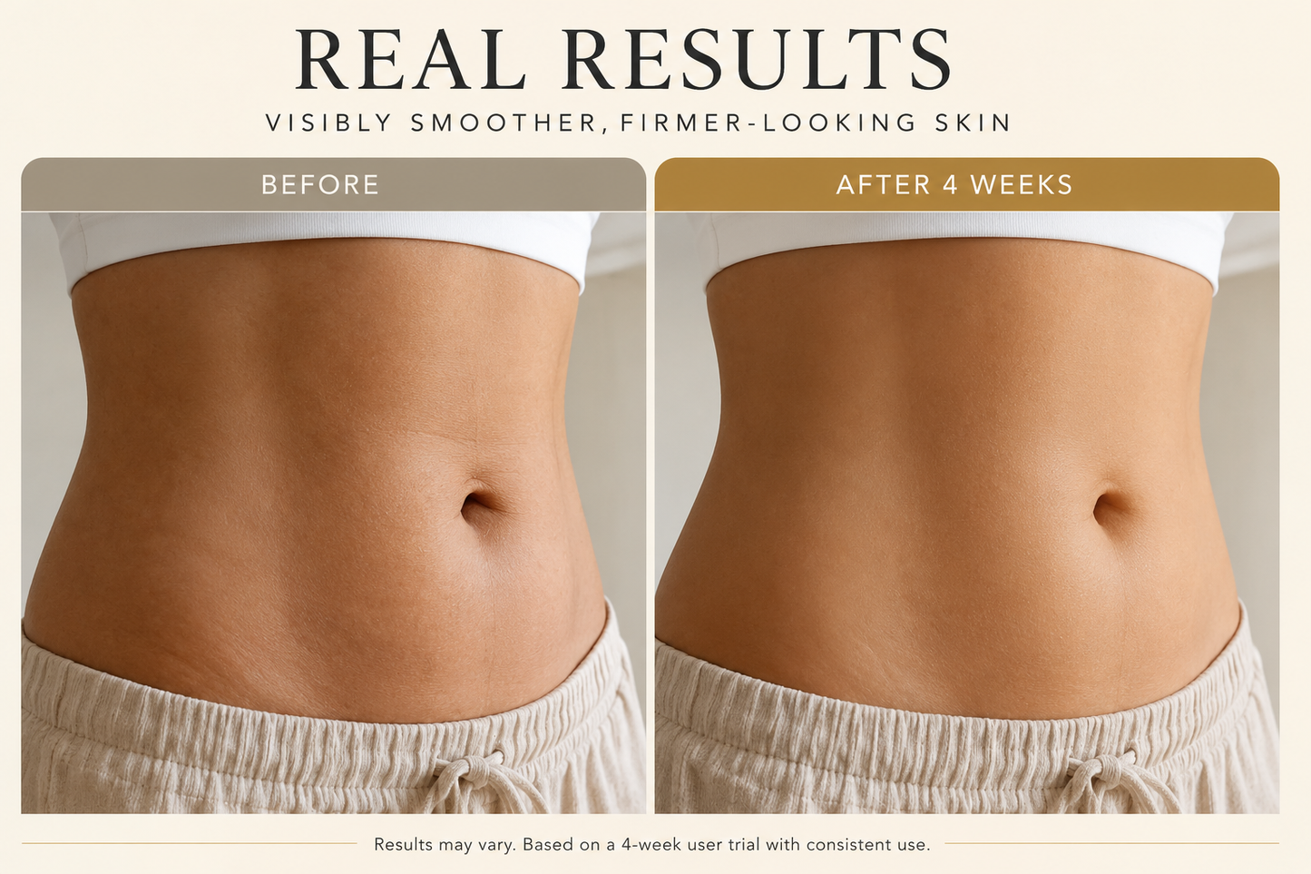 Olyrax Skin Tightening Gel